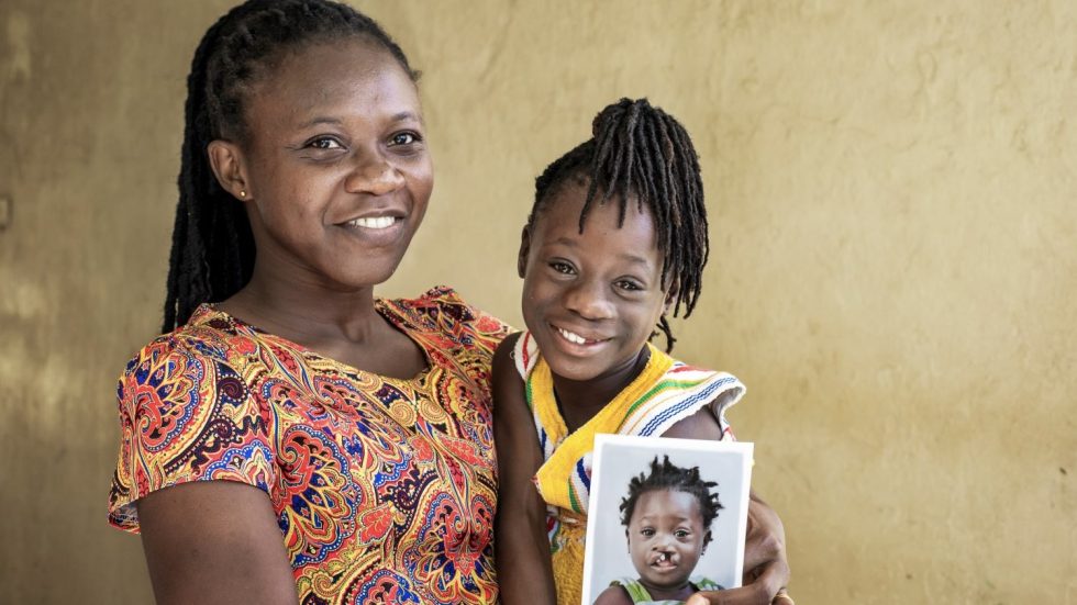 Luiss Business School al fianco di Operation Smile per “In auction for smiles”.